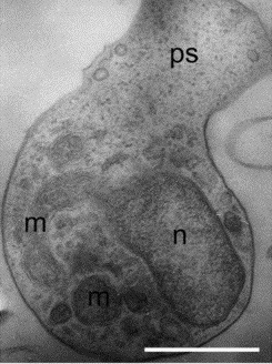 Амебоидная зооспора Amoeboaphelidium protococcarum