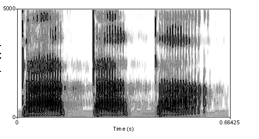 Sonogram example