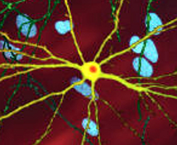 Neuron with mHTT inclusion zoomed.jpg