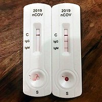 The rapid diagnostic test shows reactions of IgG and IgM antibodies. The left tray shows a negative result, and the right positive