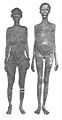 Khoikhoi women with pendulous labia visible