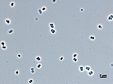 Abditibacterium utsteinense