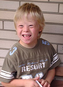 Eight year old boy with Down syndrome