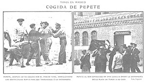 A magazine report of one of Pepete's previous injuries in 1909.