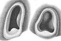 Ventral views of funnel locking apparatuses (left: 27 mm ML, right: 35 mm ML)