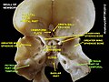 Another view of the bones of the front of the skull, viewed from behind, with the petrous part of the temporal labeled bilaterally.