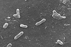 Micrografia eletrônica de varredura da B. bronchiseptica