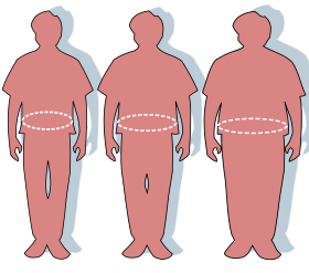 Three silhouettes depicting the outlines of an optimally sized (left), overweight (middle), and obese person (right).