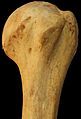 Humerus - superior epiphysis. Anterior view.