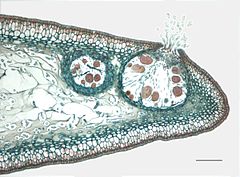 Photographie d’une coupe vue au microscope optique.