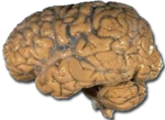 תצלום מוח אנושי
