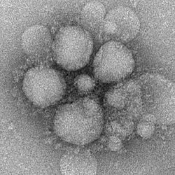 MERS-CoV electron micrograph3.jpg