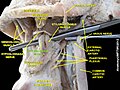 Styloglossus muscle