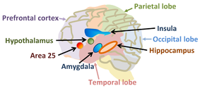 Some areas of the human brain implicated in mental disorders that might be related to free will. Area 25 refers to Brodmann's area 25, related to long-term depression.