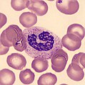 Stabkerniger neutrophiler Granulozyt