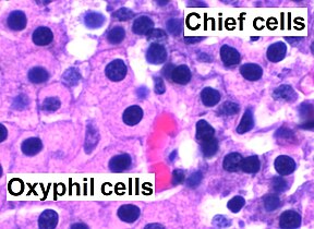 High magnification micrograph. H&E stain. The small, dark cells are chief cells, which are responsible for secreting parathyroid hormone. The cells with orange/pink staining cytoplasm are oxyphil cells
