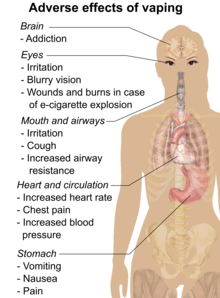 Adverse effects of vaping include throat irritation, cough, increased airway resistance, nausea, vomiting, chest pain, increased blood pressure, and increased heart rate.