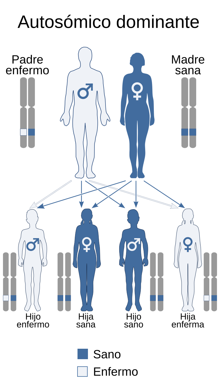 La Diabetes tipo MODY se transmite con un patrón autosómico dominante