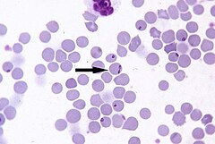 Description de l'image Babesia-divergens.jpg.