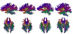 脑白质影像的生成和群组分析（Group analysis）。