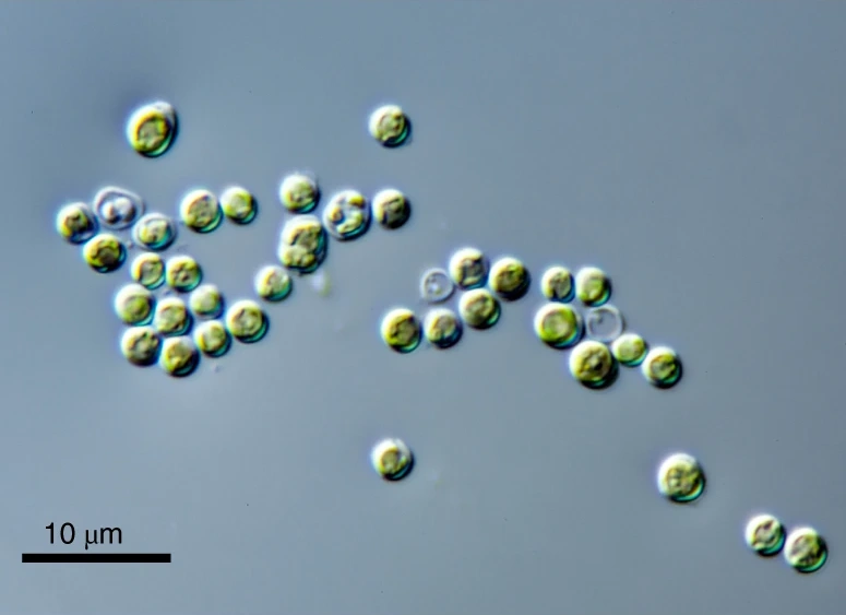 Datoteka:Prasinoderma coloniale LM.webp