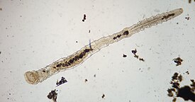 Aeolosoma hemprichii в процессе паратомии