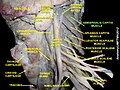 Semispinalis capitis muscle