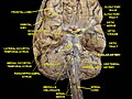 Cerebrum. Inferior view. Deep dissection