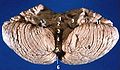 Human cerebellum anterior view description (Cerebellar hemisphere is #8)