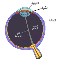 التهاب الملتحمة القرنية الحوفي العلوي