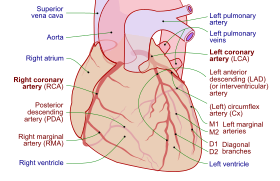 Coronary arteries (labeled in red text) and other major landmarks (in blue text). Left circumflex artery is labeled at right.