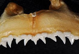 Upper teeth