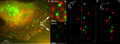 Breast Cancer Cells: 3D LIMON Dual Color Super Resolution Microscopy of Her2 and Her3 & cluster calculations