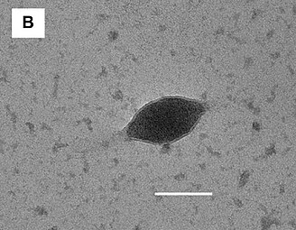 Sulfolobus tailed spindle-shaped virus 4 (STSV4), TEM-Aufnahme