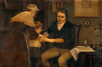 Jenner performing his first vaccination on James Phipps, a boy of age 8, on 14 May 1796