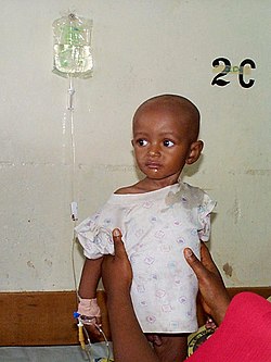 Hospitalized child with IV.JPG