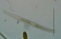 Spirostomum teres still