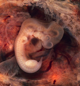Embryo by Ed Uthman