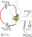 on Pinworm