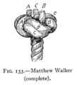 Matthew Walker knot