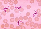 Trypanosoma parasites in blood