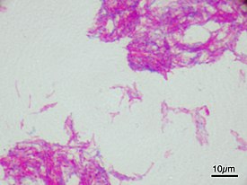 Mycobacterium bovis