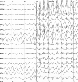 Description de l'image Spike-waves.png.