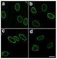 Normal nuclei (a and b) versus laminopathic nuclei (c and d), Figure 2B from Paradisi et al., 2005