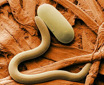Soybean cyst nematode, by the Agricultural Research Service