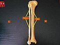 الظنبوب (قصبة الساق) (Tibia).