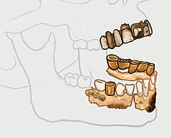Sketch of Hitler's mandible with the alveolar area and teeth in color