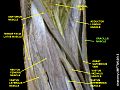 Gracilis muscle