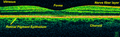 Time-Domain OCT of the macular area of a retina at 800 nm, axial resolution 3 μm
