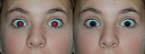 A photograph of a human with the red-eye effect and its correction right next to it